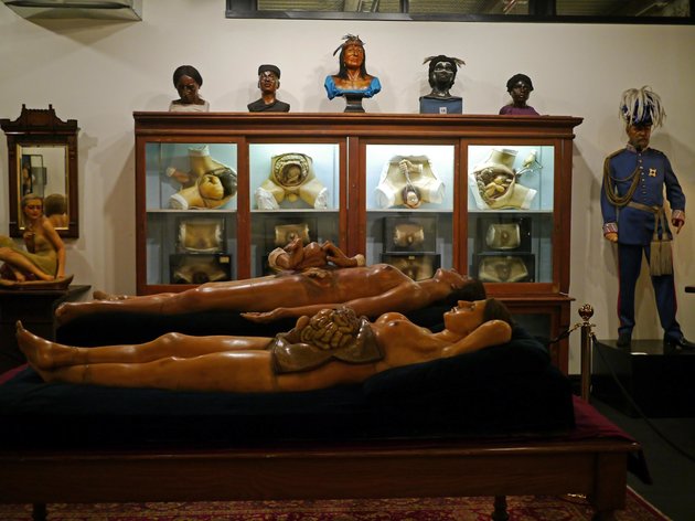 Cel mai dezgustător exponat al Muzeului este această femeie de ceară, ale cărei intestine atârnă din abdomen, alături de un embrion.