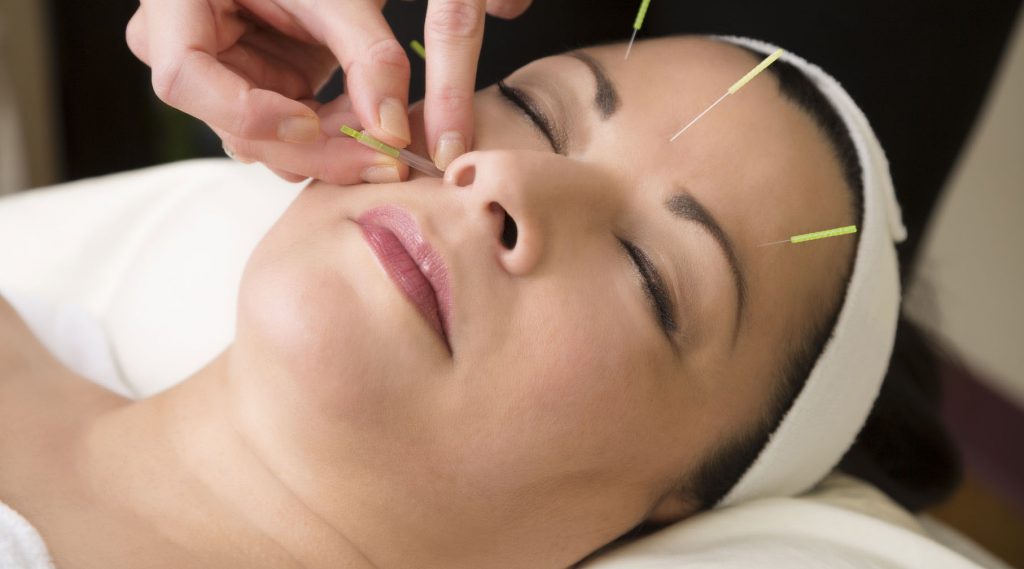 Acupunctura Bucuresti: descoperiti medicina alternativa pentru diverse afectiuni!