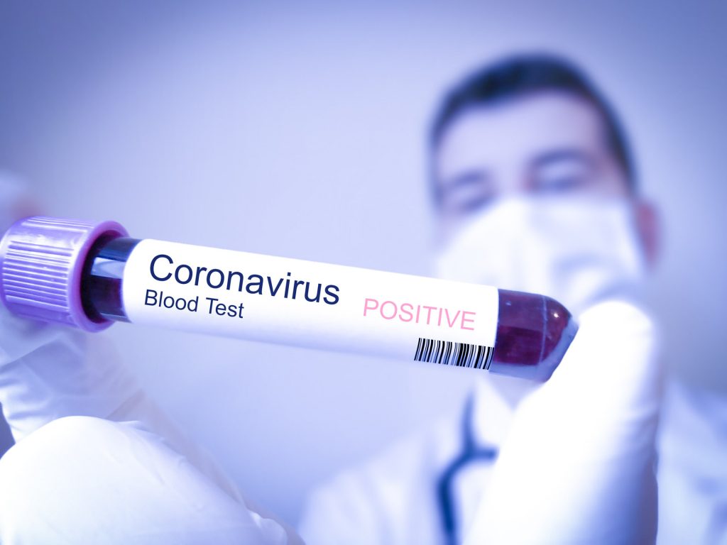 Încă un dosar penal!  A revenit din Marea Britanie cu simptome de coronavirus şi nu a respectat regulile de izolare! A luat contact cu alte persoane