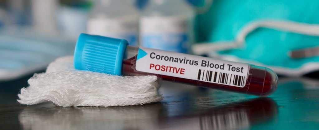 Coronavirus România. Numărul deceselor din cauza COVID-19 a ajuns la 469