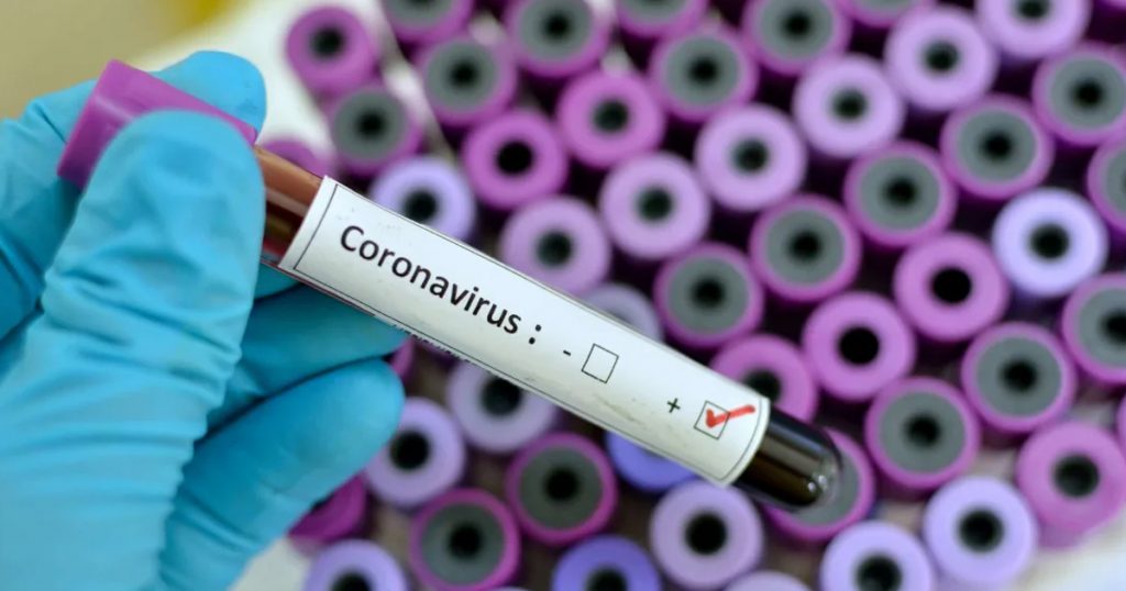 Coronavirus în România. Au fost înregistrate alte 10 decese. Bilanțul negru ajunge la 982