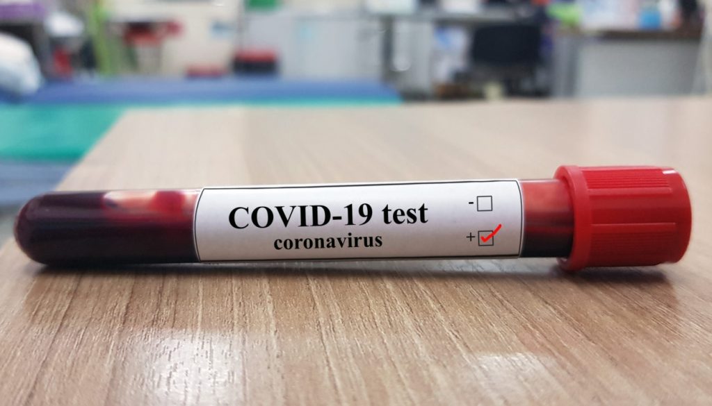 Şcolile din Capitală vor fi folosite pe post de centre de testare pentru coronavirus. Părinţii sunt revoltați