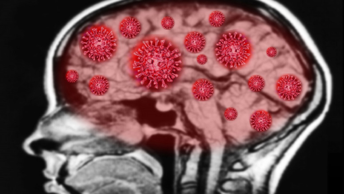 COVID-19 ne afectează inclusiv creierul, potrivit unui studio din SUA
